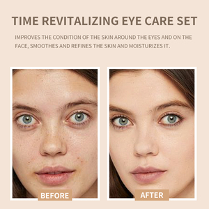 Pro-xylane Fullerene Anti-Aging koyu daire tedavisi ile gelişmiş göz bakım kiti hassas ciltler için nemlendirici 5 parçalı Set - Product Image 6
