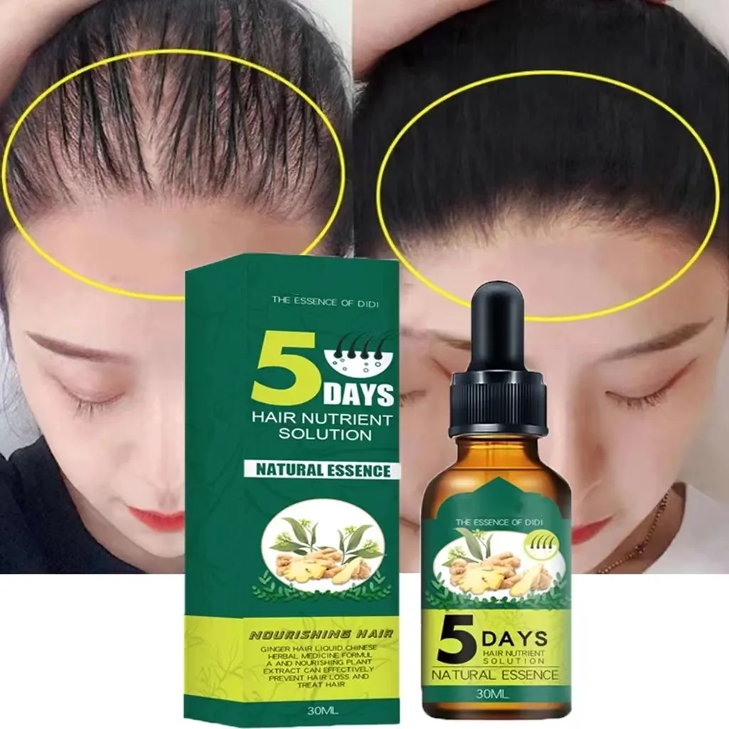 Produtos naturais contra perda de cabelo, 5 dias de gengibre tratamento de calvície crescimento rápido nutrir cabelos secos danificados cuidados