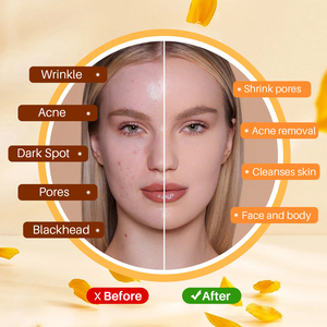 Handmade Thanh Xà Phòng Với Nghệ Kojic Axit Đu Đủ Cam Ngọt Ngào 100G Thảo Dược Làm Sạch Tắm Xà Phòng Cho Khuôn Mặt Và Cơ Thể Làm Sạch - Product Image 5