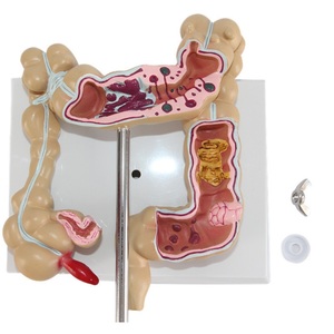 Tıbbi model beyin anorektal doktor-hasta İletişimi anatomik model insan bağırsak modeli - Product Image 2