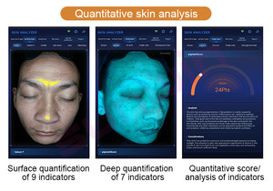 Escáner facial de espejo mágico portátil 3D AI Posicionamiento de detección facial Modo de sombra virtual Detecta 17 indicadores de piel Acné
