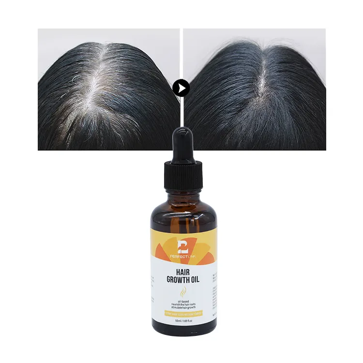 Собственная торговая марка OEM ODM, Лидер продаж, стимулирующее масло для роста волос для черных волос