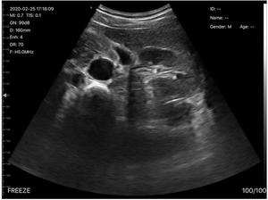 B26G Handheld Convex Cardiac Linear Ultrasound Device Wireless with Advanced Digital <strong>Imaging</strong> - Product Image 5