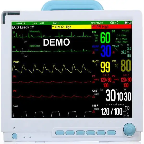 Высококачественное медицинское оборудование, модель AMPM15M +, монитор пациента с несколькими параграфами для OT/ICU/NICU