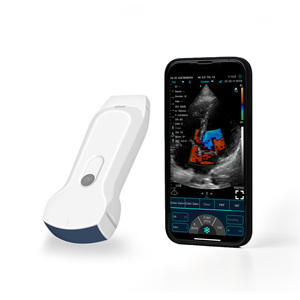 Pemindai <span class=keywords><strong>Ultrasound</strong></span> genggam, pemindai cembung tanpa kabel untuk Android iOS Windows - Product Image 4