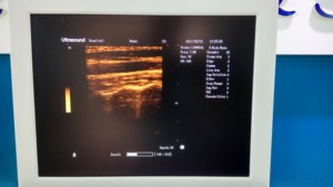 Ультразвуковой сканер с полной конфигурацией зонда - Product Image 6