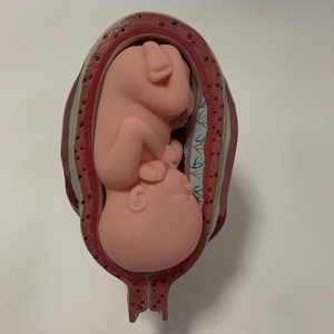 Fetus開発モデル