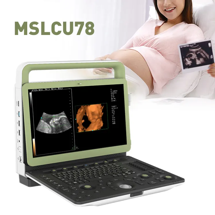 Máquina de ultrasonido doppler-4d, para el embarazo, para gyne y obs