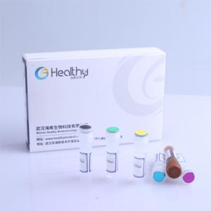 Healthymedical tıbbi araştırma lösemi gen test kiti PCR-floresan Probing İnsan 60 Fusion gen tarama kiti - Product Image 3