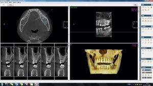 牙科器械口腔单元数字Cbct 3D OPG x光CT扫描仪MSLDX20带头影测量功能 - Product Image 3