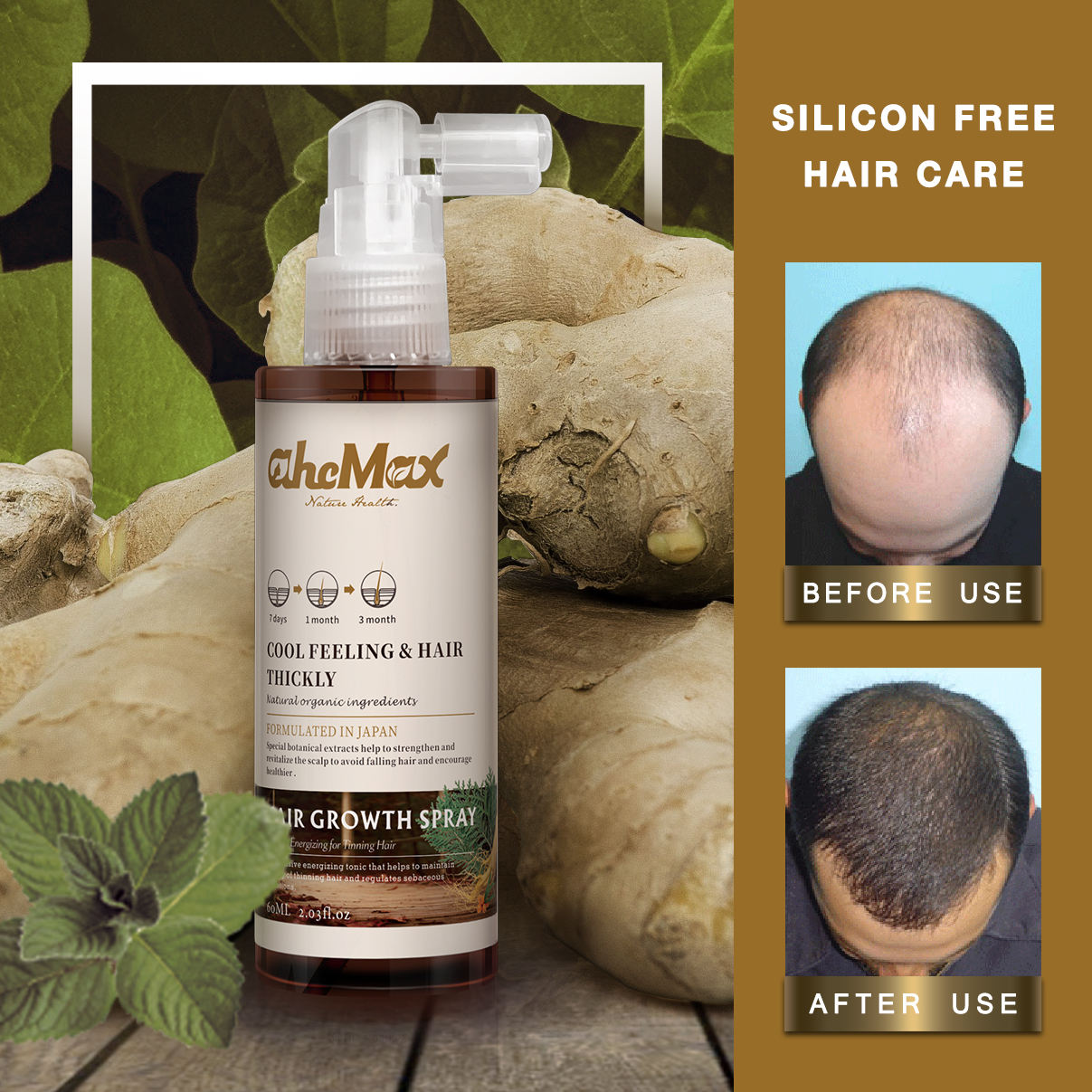 โออีเอ็ม