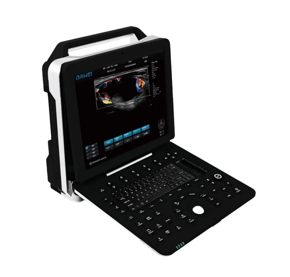 ペット病院機器デジタルカラートロリードプラー超音波スキャナーハイエンドイメージング技術ポータブル超音波スキャナー