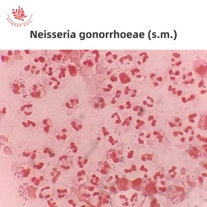 微生物学制备载玻片细菌类型高等教育球菌螺旋体杆菌混合革兰氏染色显微镜25件/套 - Product Image 3