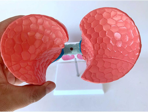 Comparison Lung Model Between Human Smoking and Drug Lung Model for Teaching Use <strong>Explanation</strong> in Hospital - Product Image 3
