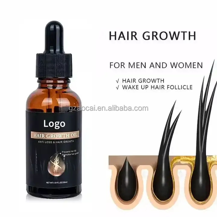 Loción anticaída de marca blanca al por mayor, producto de aceite para el crecimiento del cabello para hombres