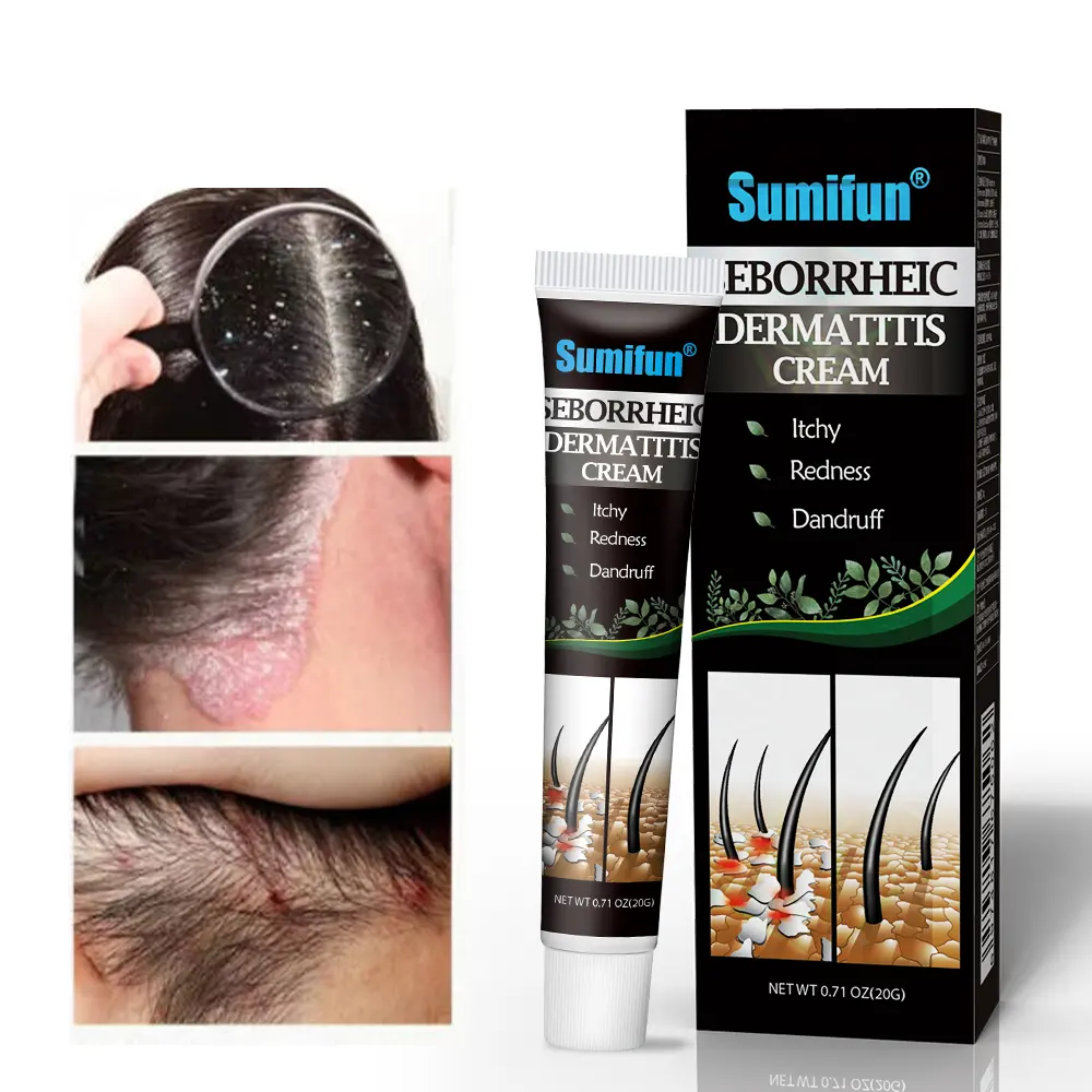 Nouveau cheveux dermatite séborrhéique crème Psoriasis eczéma maux de tête prurit shampooing supprimer les pellicules soins de la peau réparation cuir chevelu crème