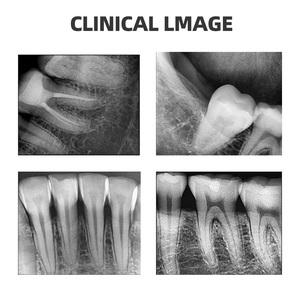 <span class=keywords><strong>Sensor</strong></span> gigi <span class=keywords><strong>Digital</strong></span> CMOS, <span class=keywords><strong>Sensor</strong></span> Dental De Rayos <span class=keywords><strong>X</strong></span> gigi palsu <span class=keywords><strong>Sensor</strong></span> Intraoral Hdr Rvg dengan koneksi Usb - Product Image 5