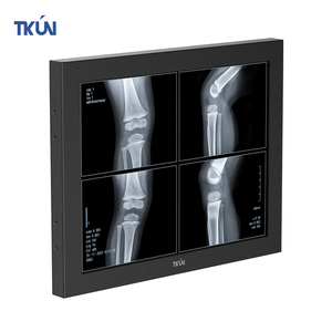 Monitores LCD versátiles de grado médico de 19/15 pulgadas con panel IPS de relación de aspecto SDI BNC 4:3 para uso de escritorio en hospitales - Product Image 2