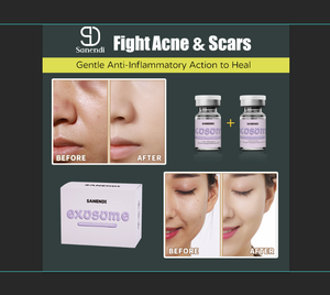 วิธีการซ่อมแซม exosome สำหรับ Microneedle ใช้ในการฟื้นฟูและกระชับผิว - Product Image 5