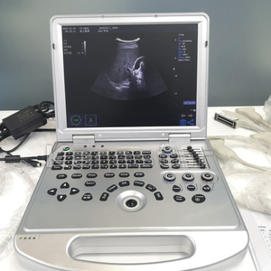 Low Cost Laptop Ultrasound Machine Real Time <strong>4D</strong> 5D Veterinary Color Doppler Ultrasonic Scan Machine Price - Product Image 4