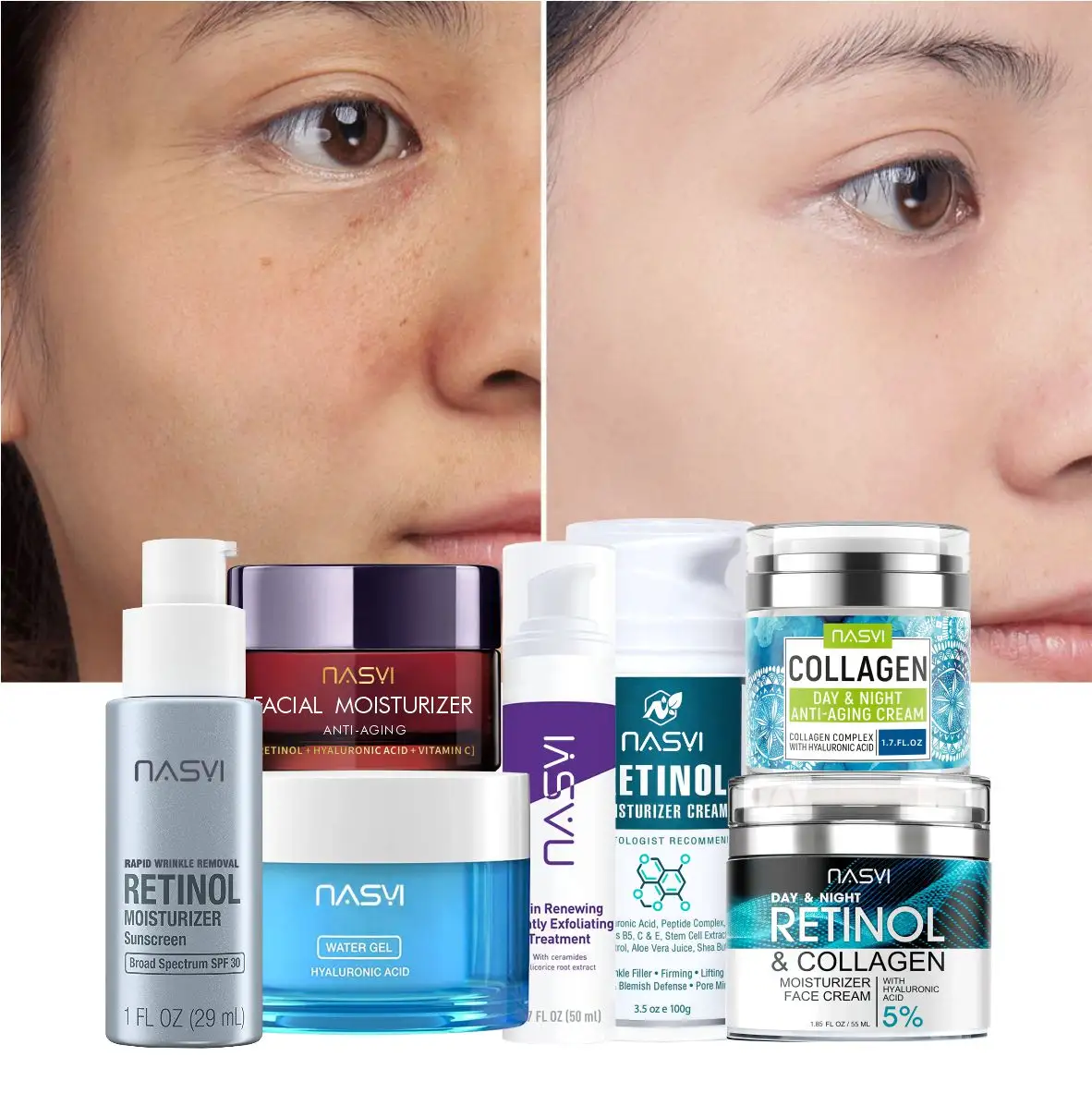 NASYI Private Label Acne/Melasma Spot Cream Anti-Aging Whitening Facial Freckle Removal Morning/Night Cream