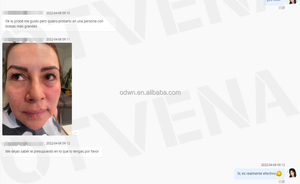 Otvena 2025 xu hướng dưới mắt Kem mắt túi loại bỏ ngay lập tức Kem mắt - Product Image 5