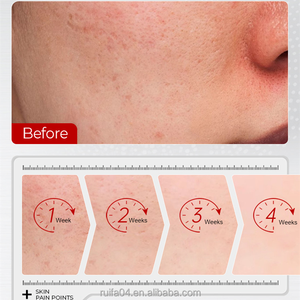 Lucenbase Hữu Cơ đốm đen tàn nhang loại bỏ chăm sóc da mặt Kit Giữ ẩm trẻ hóa sáng làm trắng chăm sóc da bộ - Product Image 5