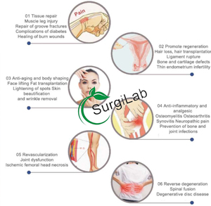 Dùng một lần tiểu Cầu Plasma <span class=keywords><strong>tricell</strong></span> <span class=keywords><strong>PRP</strong></span> Ống <span class=keywords><strong>kit</strong></span> tiểu cầu phong phú Plasma cho đau quản lý phẫu thuật thẩm mỹ cho bác sĩ thú y động vật - Product Image 5