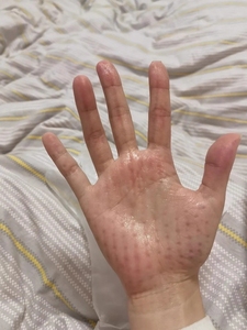 Masajeador Eléctrico de Manos con Función de Presión para Aliviar el Síndrome del Túnel Carpiano y la Dormencia de los Dedos, con Terapia de Calor - Product Image 4