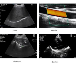 Scanner à ultrasons Doppler couleur convexe, linéaire et cardiaque Garantie 2 ans Sonde à ultrasons sans fil 3 en 1 - Product Image 3