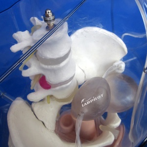 透明子宮内植樹シミュレーター外科中絶教育モデルGyn Care Manikin