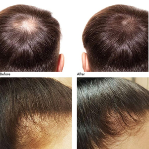 Saç büyüme tedavisi hızlı saç büyüme serum doğal saç büyüme yağı - Product Image 6