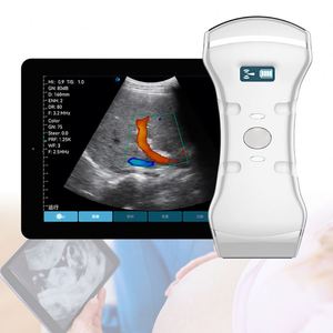 Draagbare Kleur <span class=keywords><strong>Doppler</strong></span> Ultrasone Systeem Prijs Draadloze Echografie Sonde - Product Image 1