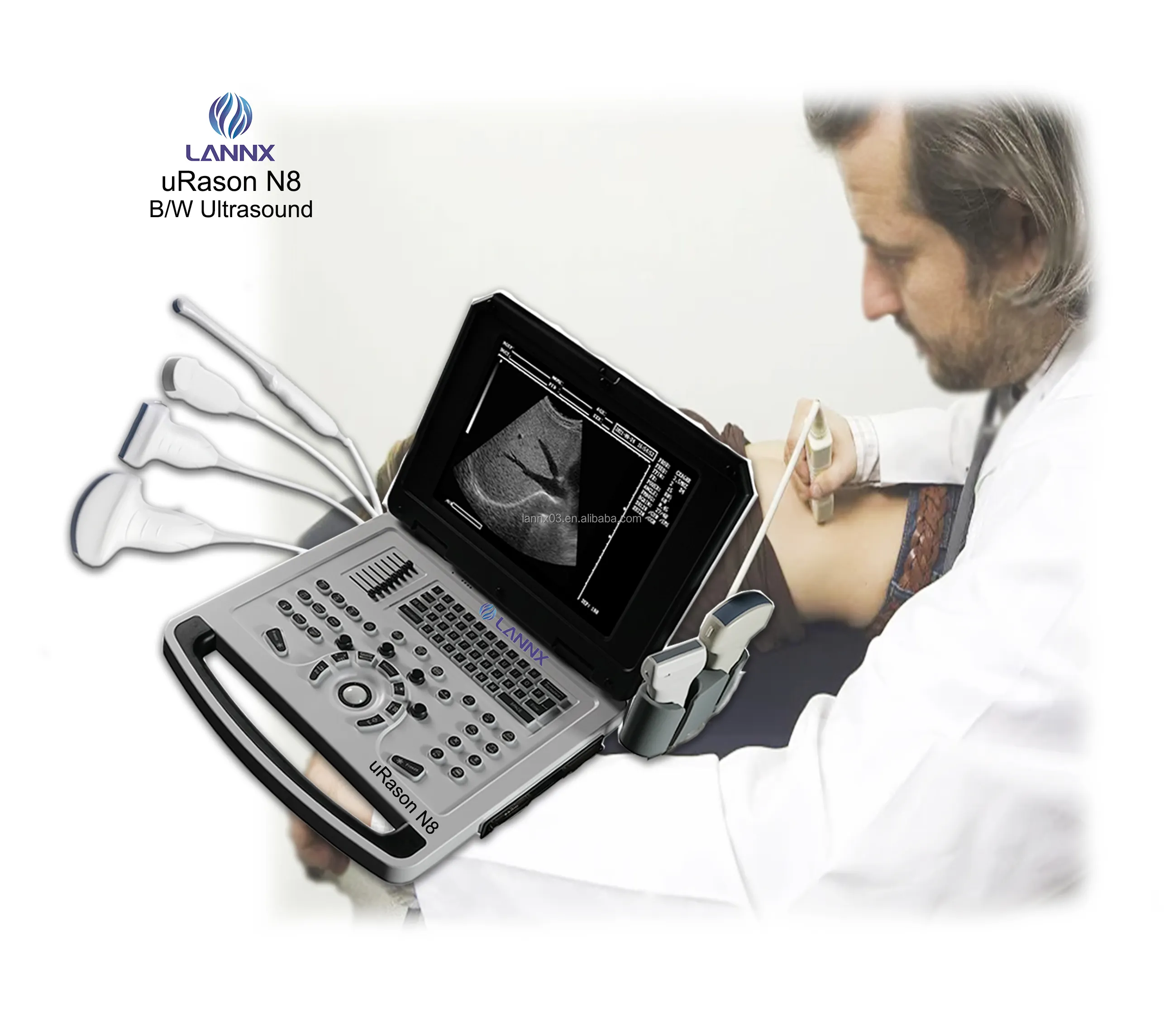 LANNX uRason N8 Krankenhaus Elektrische Ultraschall diagnose geräte tragbarer Ultraschalls canner Schwarzweiß-Ultraschall gerät
