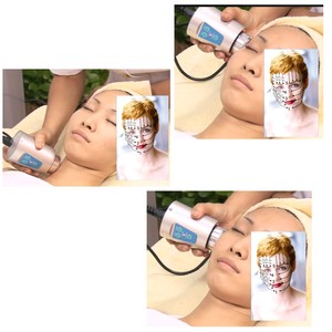 28 Years Factory Beauty Design Home Use High Frequency Facial <strong>Toning</strong> Device for Skin Rejuvenation Face Lifting Device - Product Image 2