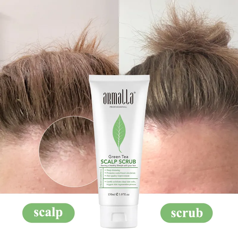 Özel saç derisi bakımı tedavi Anti kepek şampuan organik temizlemek Peeling soyma detoks YEŞİL ÇAY deniz tuzu saç derisi fırçalayın