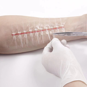 Y tế tùy chỉnh dùng một lần vô trùng Dải gia cố da dây kéo vết thương da đóng cửa thiết bị - Product Image 1