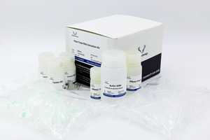 Bitki toplam RNA ekstraksiyon kiti, birçok yayınla sıcak satış - Product Image 2