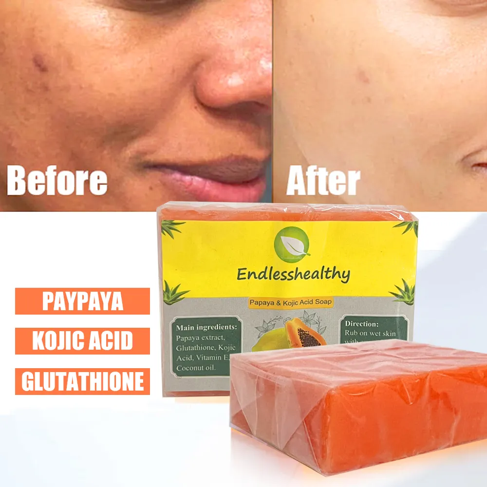 OEM के थोक प्राकृतिक हस्तनिर्मित चेहरा साबुन बार kojie सैन kojic एसिड साबुन glutathione पपीता whitening साबुन