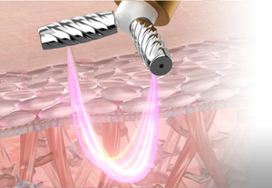 11 in <strong>1</strong> Professional Table Blackhead Removal Device No <strong>Needle</strong> Mesotherapy Machine