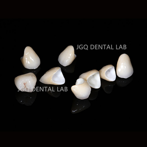 CAD CAM hazır zirkonya Crowns hızlı freze STL dosya desteği 3 şekil Exocad uyumlu - Product Image 5