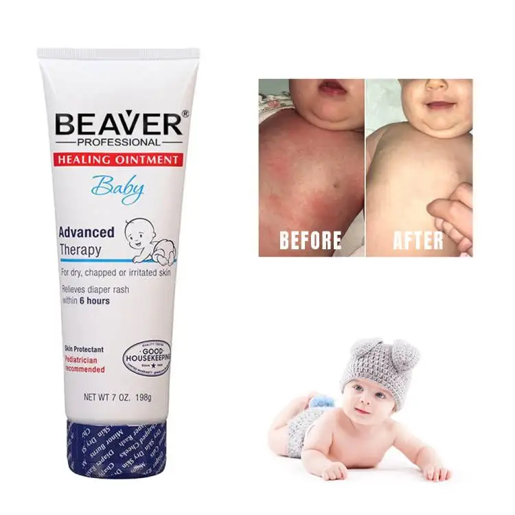 Private Label Großhandel Low Moq Original Aquapher Baby Rash Heils albe Schützen Sie die Hautpflege Windel creme für Babys