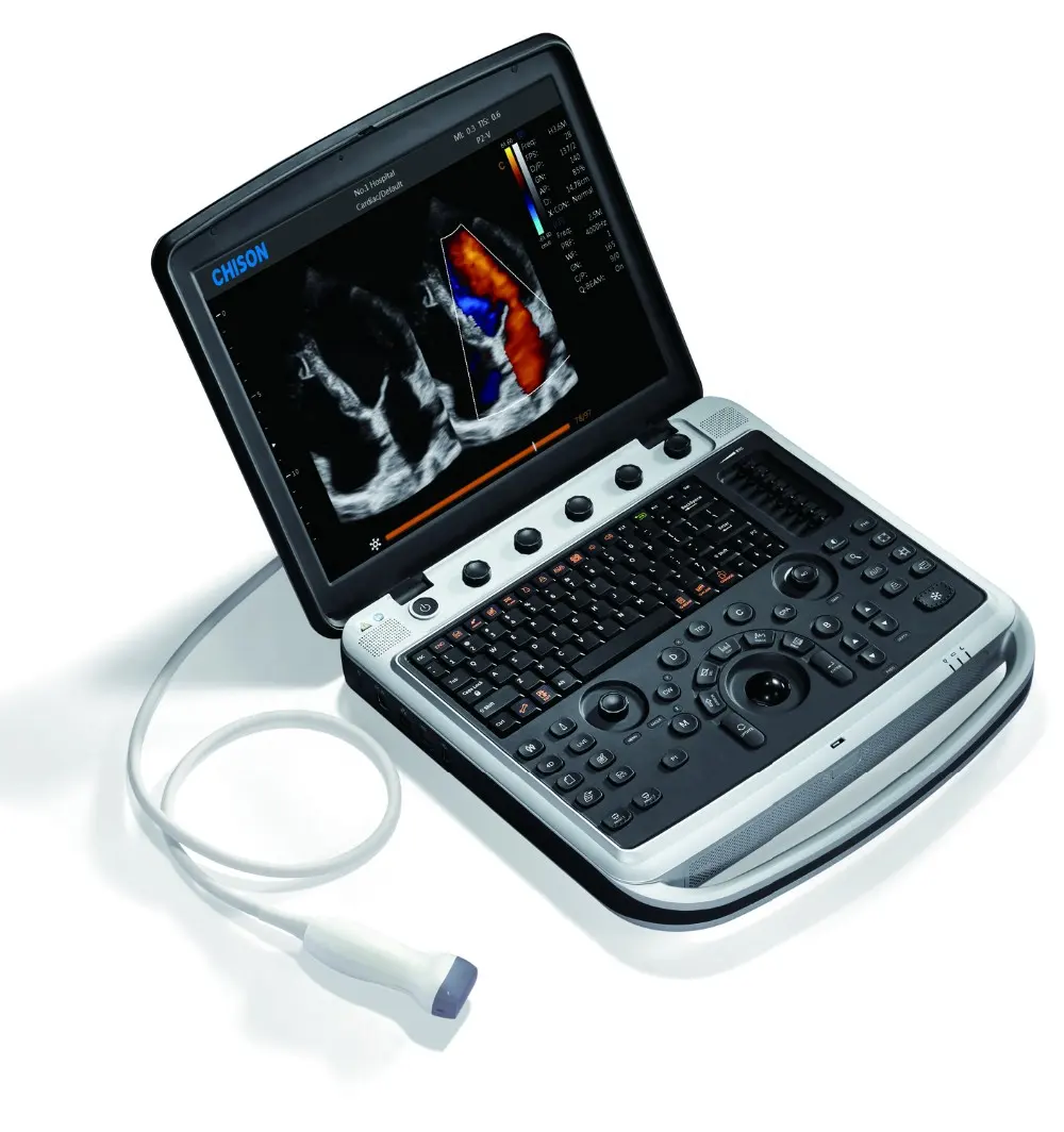 Máquina de escáner de ultrasonido portátil 4D equipo veterinario Hospital Médico