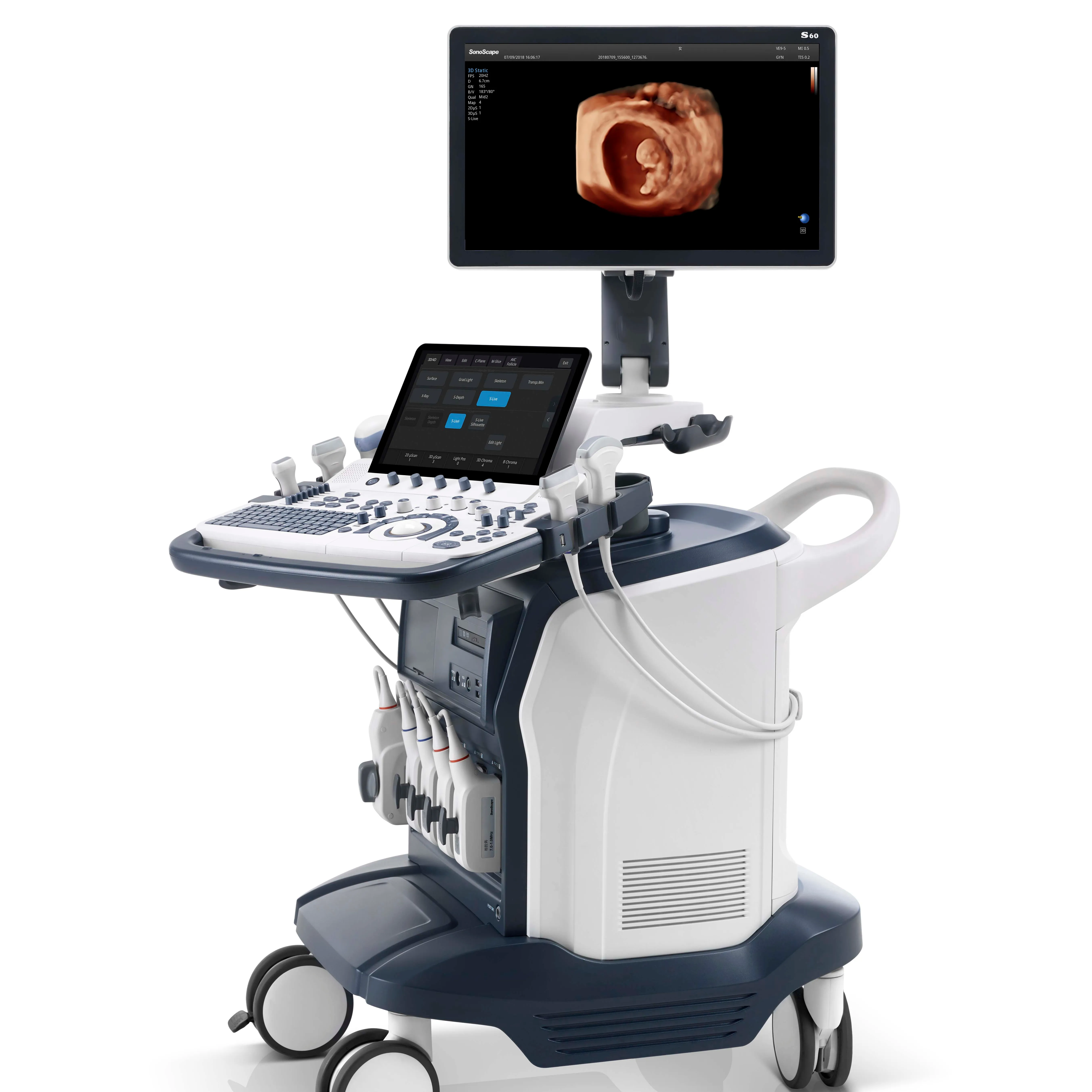 SONOSCAPE s60 scanner à ultrasons machine à échographie avec transducteur volumétrique cardiaque linéaire convexe guide d'aiguille