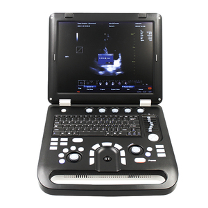 CONTEC CMS1700C医療用超音波機器中国超音波マシン - Product Image 2