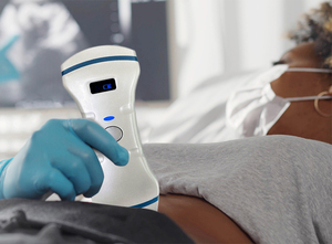 Scanner à ultrasons Doppler couleur convexe, linéaire et cardiaque Garantie 2 ans Sonde à ultrasons sans fil 3 en 1 - Product Image 5