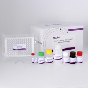 <span class=keywords><strong>Kit</strong></span> de <span class=keywords><strong>test</strong></span> d'anticorps cELISA de type 2 (<span class=keywords><strong>PCV2</strong></span>) <span class=keywords><strong>Circovirus</strong></span> porcin-Haute sensibilité et spécificité pour les diagnostics vétérinaires - Product Image 4