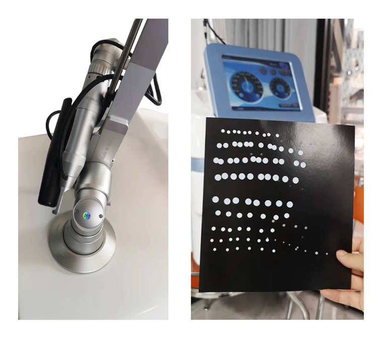 picoway pigment removal