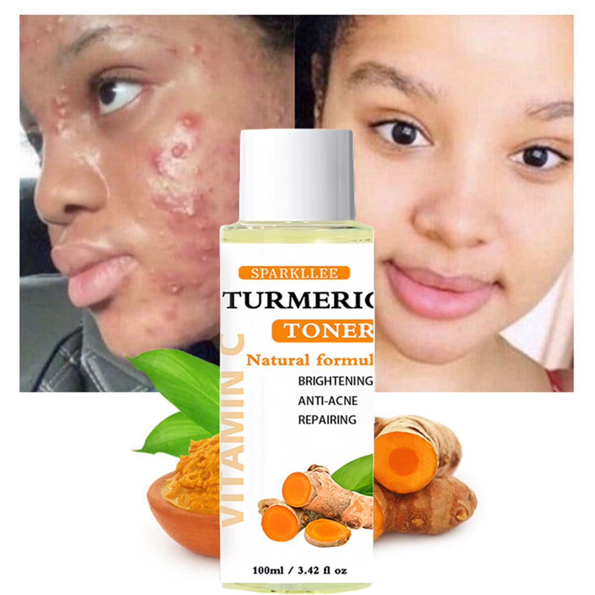 100ml Curcuma Vitamine C