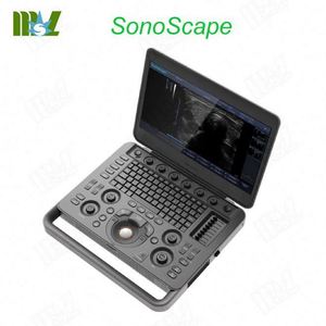 Tiên tiến và di động SONOSCAPE X3 kỹ thuật số siêu âm DOPPLER màu máy siêu âm - Product Image 1